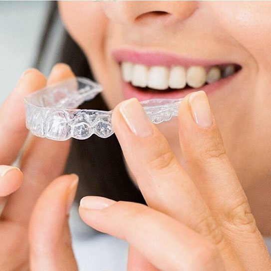 Invisalign: Creating Beautiful Straight Smiles in Ontario - Euclid Dental Center - Invisalign,Ontario,Chino,Invisalign near me Invisalign near me Ontario Chino